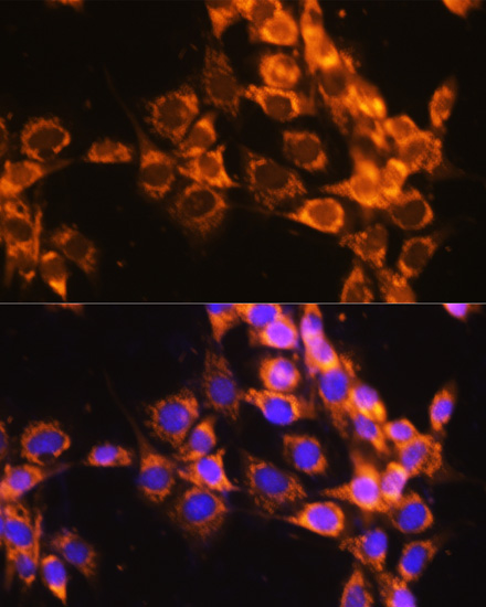 Immunofluorescence - ACAT1 Polyclonal Antibody 