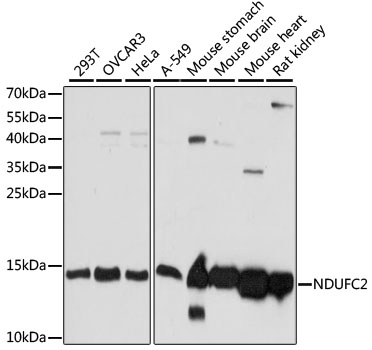 Western blot - NDUFC2 Polyclonal Antibody 