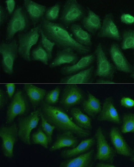 Immunofluorescence - PTPN22 Polyclonal Antibody 