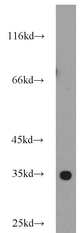 human testis tissue were subjected to SDS PAGE followed by western blot with Catalog No:114238(PRPS1L1 antibody) at dilution of 1:1000