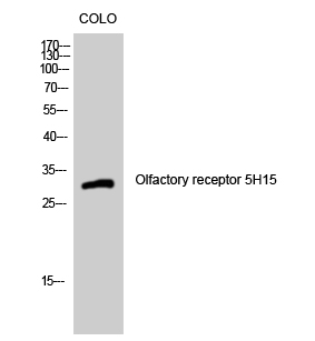 Fig1:; Western Blot analysis of COLO cells using Olfactory receptor 5H15 Polyclonal Antibody