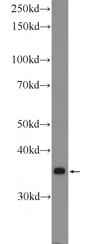mouse liver tissue were subjected to SDS PAGE followed by western blot with Catalog No:109487(COX18 Antibody) at dilution of 1:600