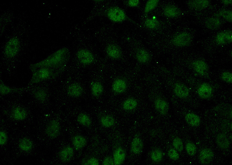 Immunofluorescent analysis of (-20oc Acetone) fixed SH-SY5Y cells using Catalog No:110715(FOXR2 Antibody) at dilution of 1:50 and Alexa Fluor 488-congugated AffiniPure Goat Anti-Rabbit IgG(H+L)
