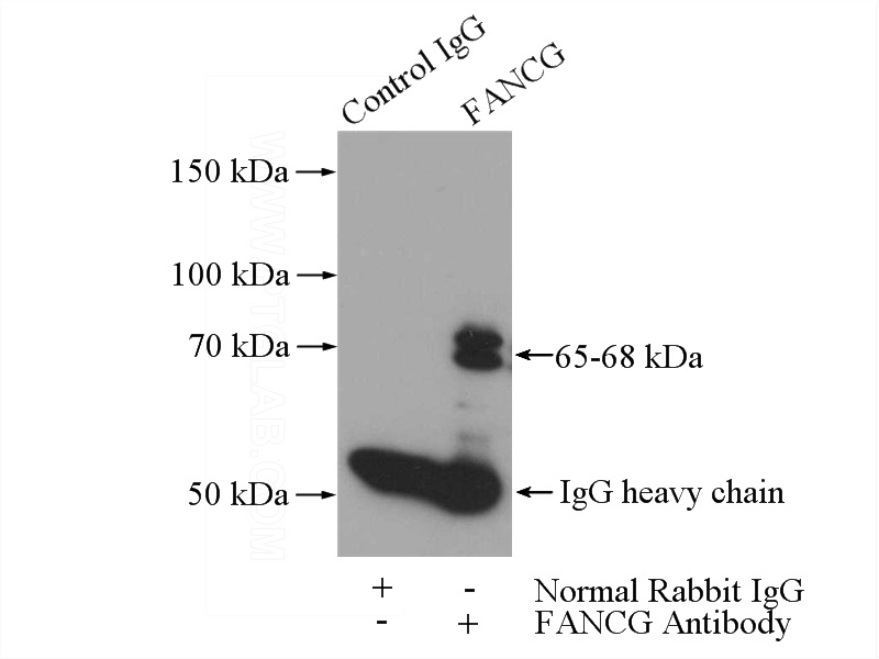 IP Result of anti-FANCG (IP:Catalog No:110519, 4ug; Detection:Catalog No:110519 1:300) with mouse testis tissue lysate 4000ug.