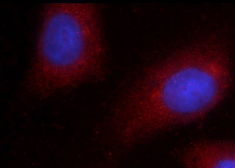 Immunofluorescent analysis of HepG2 cells using Catalog No:107307(GSNOR,ADH5 Antibody) at dilution of 1:50 and Rhodamine-Goat anti-Mouse IgG