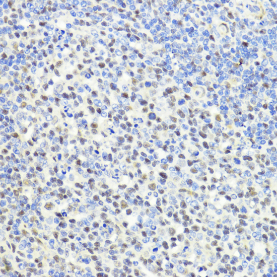 Immunohistochemistry - CTCF Polyclonal Antibody 