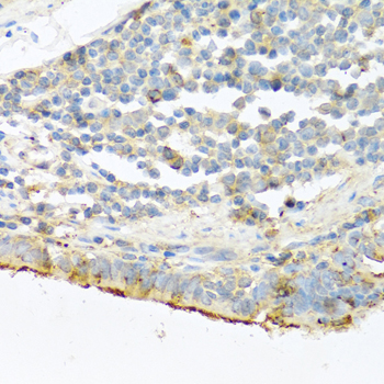 Immunohistochemistry - PRSS1 Polyclonal Antibody 