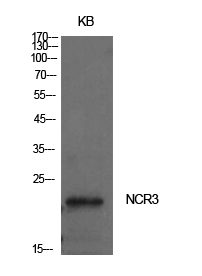 Fig1:; Western Blot analysis of KB cells using NKp30 Polyclonal Antibody.. Secondary antibody（catalog#: HA1001) was diluted at 1:20000