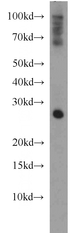 mouse brain tissue were subjected to SDS PAGE followed by western blot with Catalog No:115445(SNAP antibody) at dilution of 1:1500