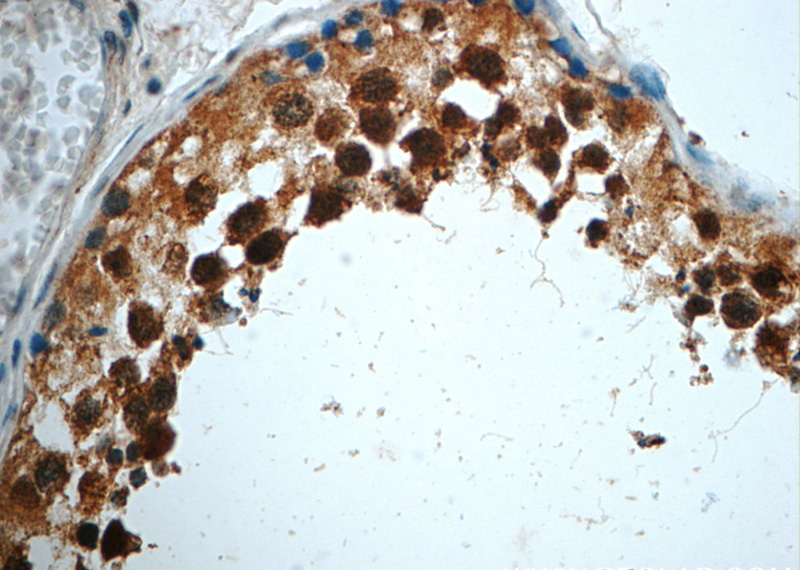 Immunohistochemistry of paraffin-embedded human testis slide using Catalog No:108867(CSNK2B Antibody) at dilution of 1:50