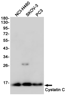 Western blot detection of Cystatin C in NCI-H460,SKOV-3,PC3 cell lysates using Cystatin C (6A4) Mouse mAb(1:1000 diluted).Predicted band size:14KDa.Observed band size:14KDa.