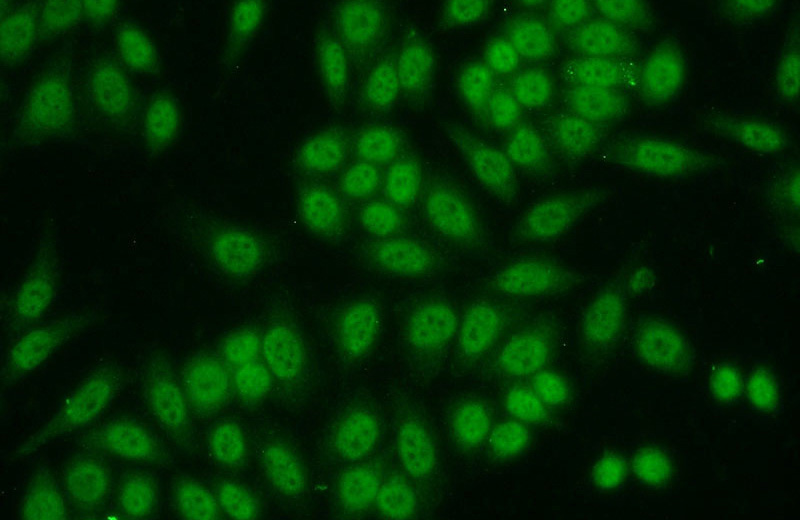 Immunofluorescent analysis of HeLa cells using Catalog No:115521(SP1 Antibody) at dilution of 1:50 and Alexa Fluor 488-congugated AffiniPure Goat Anti-Rabbit IgG(H+L)