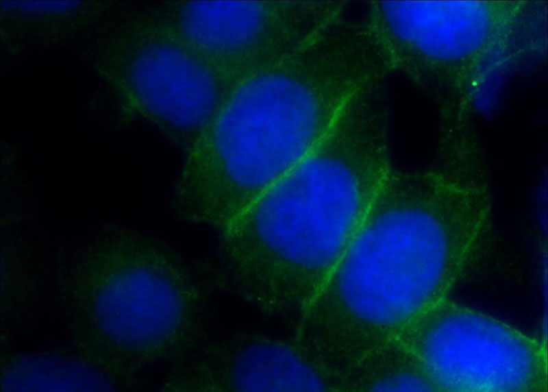 Immunofluorescent analysis of HeLa cells using Catalog No:114012(PLSCR1 Antibody) at dilution of 1:50 and Alexa Fluor 488-congugated AffiniPure Goat Anti-Rabbit IgG(H+L)