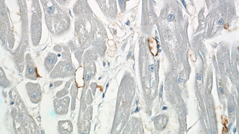 Immunohistochemistry of paraffin-embedded human heart slide using Catalog No:110401(ERBB2IP Antibody) at dilution of 1:50