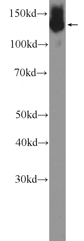 Jurkat cells were subjected to SDS PAGE followed by western blot with Catalog No:113142(NFATC2 Antibody) at dilution of 1:1000