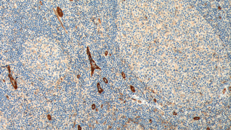 Immunohistochemistry of paraffin-embedded human tonsillitis tissue slide using Catalog No:107036(CCBP2 Antibody) at dilution of 1:400 (under 10x lens). heat mediated antigen retrieved with Tris-EDTA buffer(pH9).