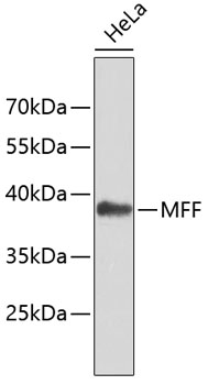 Western blot - MFF Polyclonal Antibody 