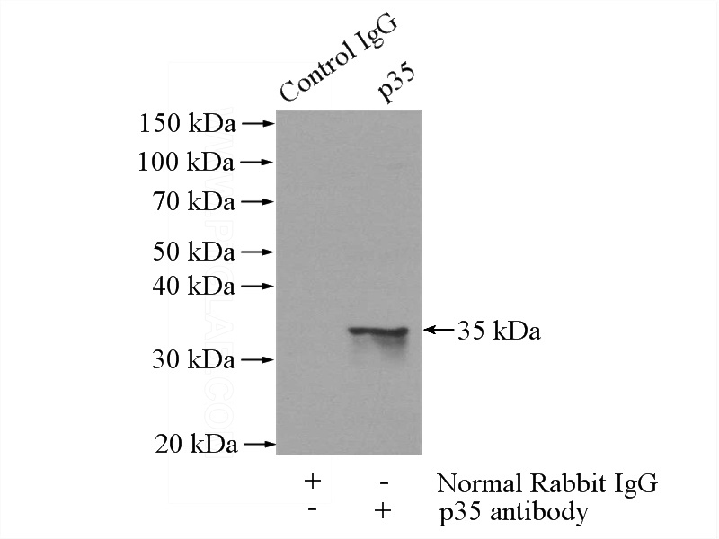 IP Result of anti-CDK5R1 (IP:Catalog No:113548, 4ug; Detection:Catalog No:113548 1:500) with mouse brain tissue lysate 3440ug.