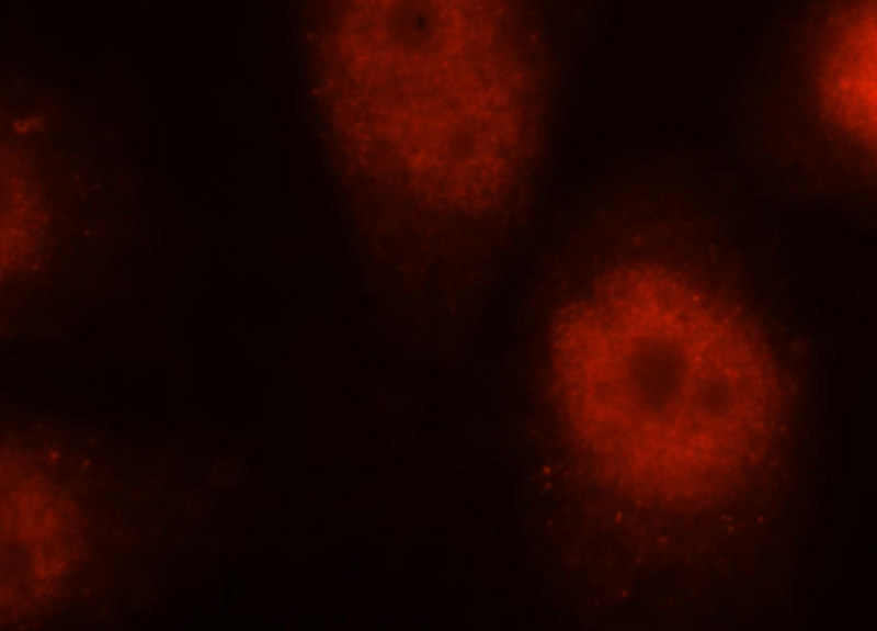 Immunofluorescent analysis of Hela cells, using DBR1 antibody Catalog No:109880 at 1:25 dilution and Rhodamine-labeled goat anti-rabbit IgG (red).