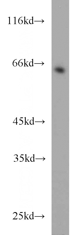 mouse spleen tissue were subjected to SDS PAGE followed by western blot with Catalog No:114642(RGS14 antibody) at dilution of 1:500