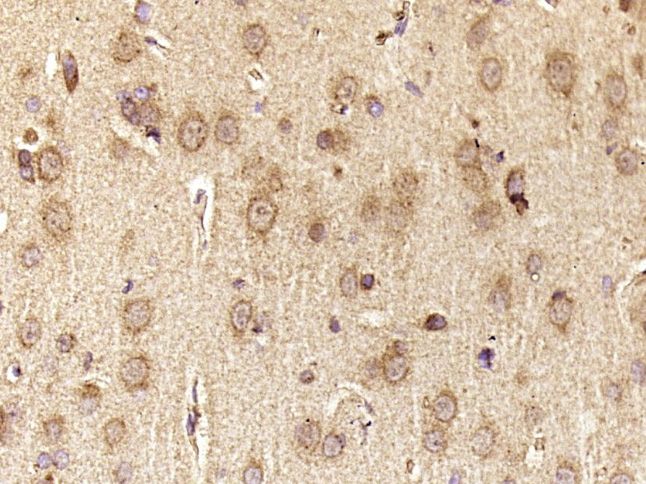 Fig3: Paraformaldehyde-fixed, paraffin embedded (Rat brain); Antigen retrieval by boiling in sodium citrate buffer (pH6.0) for 15min; Block endogenous peroxidase by 3% hydrogen peroxide for 20 minutes; Blocking buffer (normal goat serum) at 37℃ for 30min; Antibody incubation with (HERC6) Polyclonal Antibody, Unconjugated at 1:400 overnight at 4℃, followed by operating according to SP Kit(Rabbit) (sp-0023) instructionsand DAB staining.