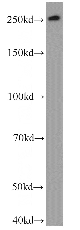 HeLa cells were subjected to SDS PAGE followed by western blot with Catalog No:112891(MUC4 antibody) at dilution of 1:500