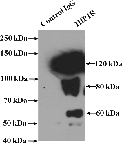 IP Result of anti-HIP1R (IP:Catalog No:111354, 4ug; Detection:Catalog No:111354 1:1000) with mouse brain tissue lysate 4000ug.
