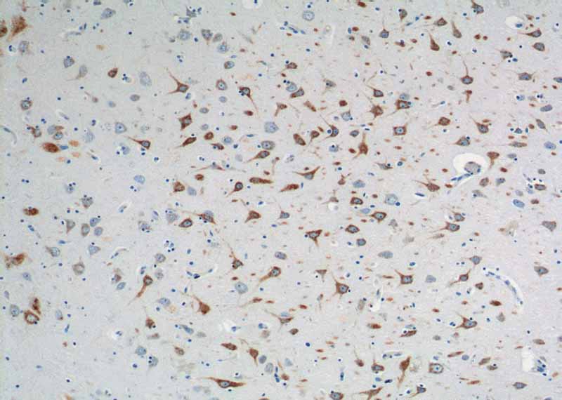 Immunohistochemistry of paraffin-embedded human brain tissue slide using Catalog No:110719(FPR2 Antibody) at dilution of 1:200 (under 10x lens).