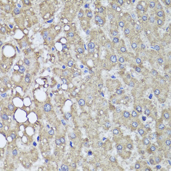 Immunohistochemistry - PIK3C2A Polyclonal Antibody 