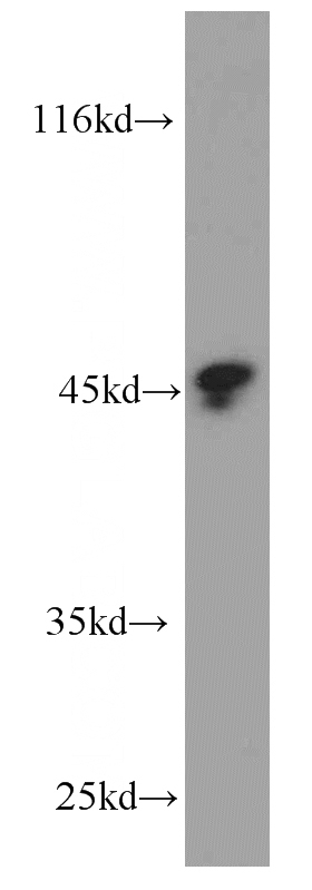 human testis tissue were subjected to SDS PAGE followed by western blot with Catalog No:107487(SERPINA5 antibody) at dilution of 1:1000
