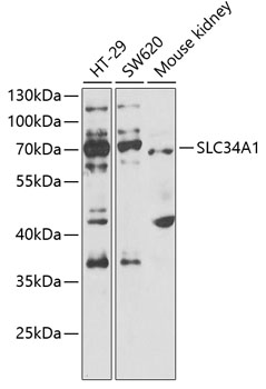 Western blot - SLC34A1 Polyclonal Antibody 