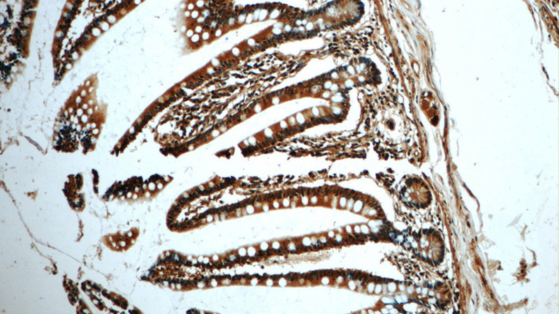 Immunohistochemistry of paraffin-embedded human small intestine tissue slide using Catalog No:107154(CHK1 Antibody) at dilution of 1:50 (under 10x lens)