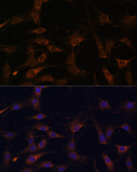Immunofluorescence - RAB21 Polyclonal Antibody 