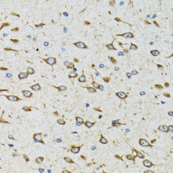 Immunohistochemistry - AKTIP Polyclonal Antibody 