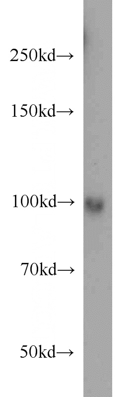 human liver tissue were subjected to SDS PAGE followed by western blot with Catalog No:107407(LONP1 antibody) at dilution of 1:500