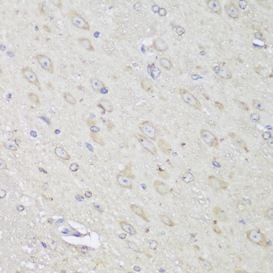 Immunohistochemistry - GANAB Polyclonal Antibody 