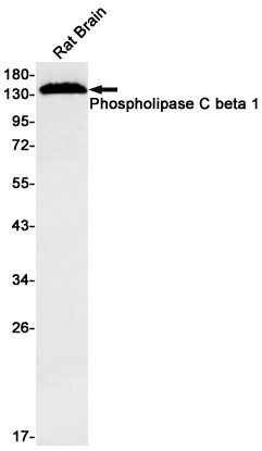 Western blot detection of Phospholipase C beta 1 in Rat Brain lysates using Phospholipase C beta 1 Rabbit mAb(1:500 diluted).Predicted band size:138kDa.Observed band size:138kDa.