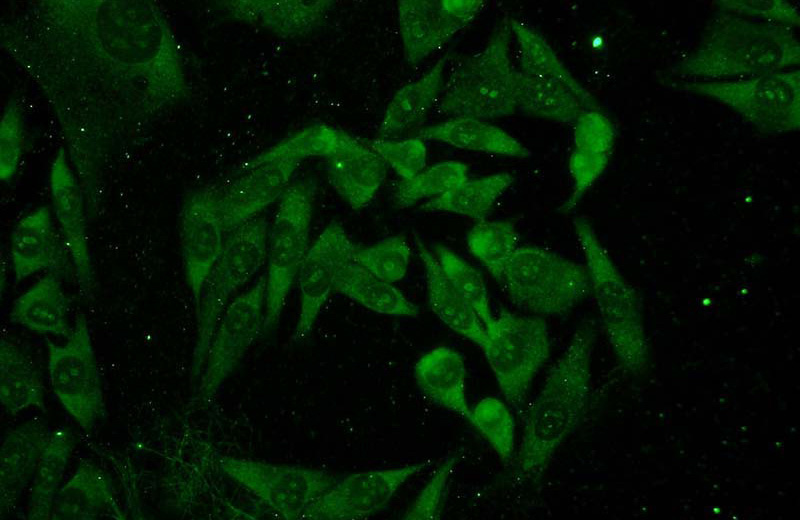 Immunofluorescent analysis of A375 cells using Catalog No:110537(FBL Antibody) at dilution of 1:50 and Alexa Fluor 488-congugated AffiniPure Goat Anti-Rabbit IgG(H+L)