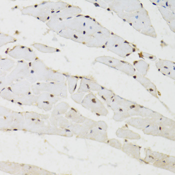 Immunohistochemistry - BAZ1B Polyclonal Antibody 