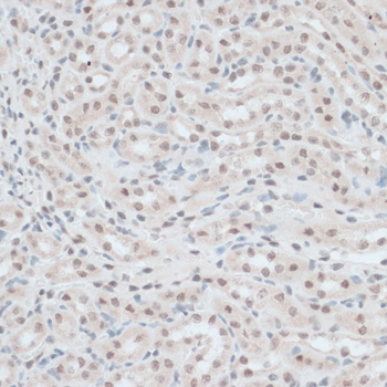 Immunohistochemistry - ZNF416 Polyclonal Antibody 