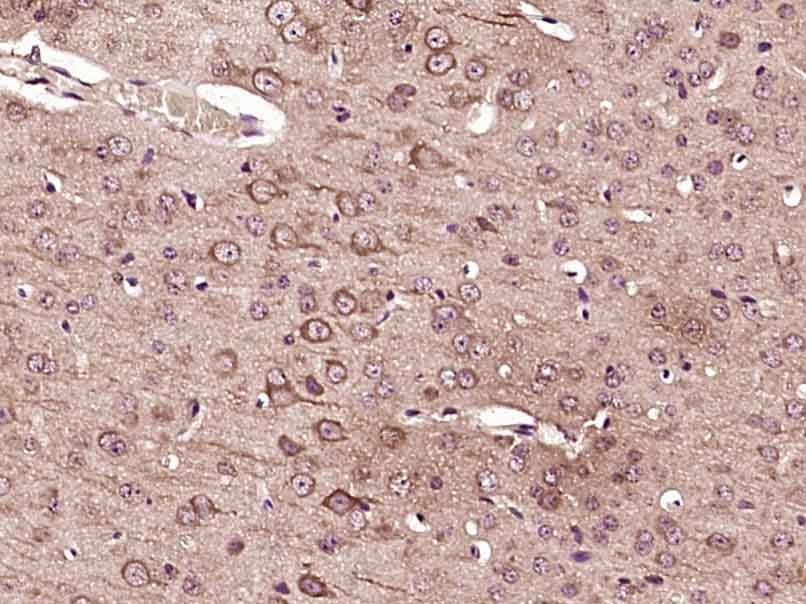 Fig1: Paraformaldehyde-fixed, paraffin embedded (Mouse brain); Antigen retrieval by boiling in sodium citrate buffer (pH6.0) for 15min; Block endogenous peroxidase by 3% hydrogen peroxide for 20 minutes; Blocking buffer (normal goat serum) at 37℃ for 30min; Antibody incubation with (FAM98C) Polyclonal Antibody, Unconjugated at 1:400 overnight at 4℃, followed by operating according to SP Kit(Rabbit) (sp-0023) instructionsand DAB staining.