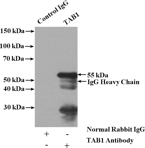 IP Result of anti-MAP3K7IP1 (IP:Catalog No:115964, 4ug; Detection:Catalog No:115964 1:600) with K-562 cells lysate 3200ug.