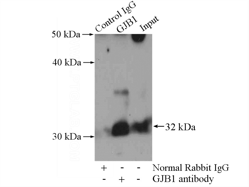 IP Result of anti-Cx32 (IP:Catalog No:109452, 4ug; Detection:Catalog No:109452 1:300) with mouse brain tissue lysate 4000ug.