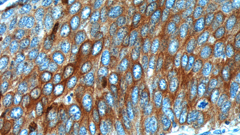 Cytokeratin 17 Rabbit Polyclonal antibody