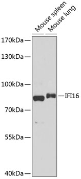 Western blot - IFI16 Polyclonal Antibody 