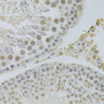 Immunohistochemistry - HDGF Polyclonal Antibody 