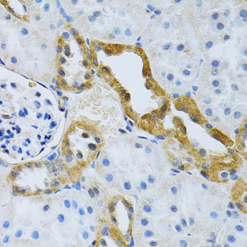 Immunohistochemistry - SLC4A5 Polyclonal Antibody 