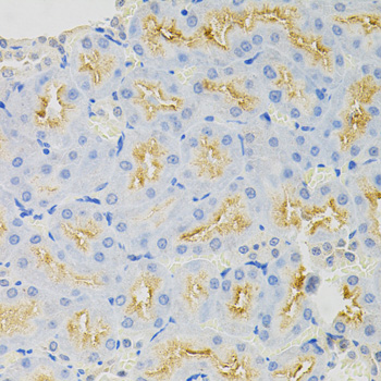 Immunohistochemistry - SYK Polyclonal Antibody 