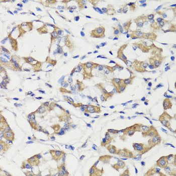 Immunohistochemistry - DEPDC6 Polyclonal Antibody 