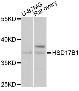 Western blot - HSD17B1 Polyclonal Antibody 